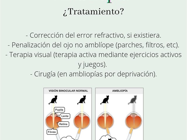 Ambliopía. ¿Tratamiento?