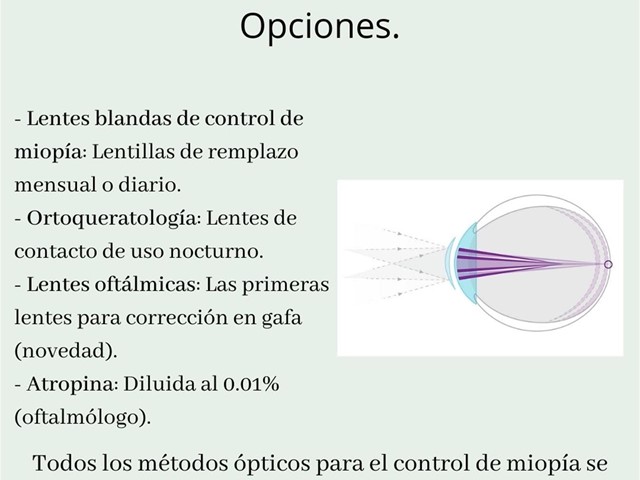 Control de miopía.