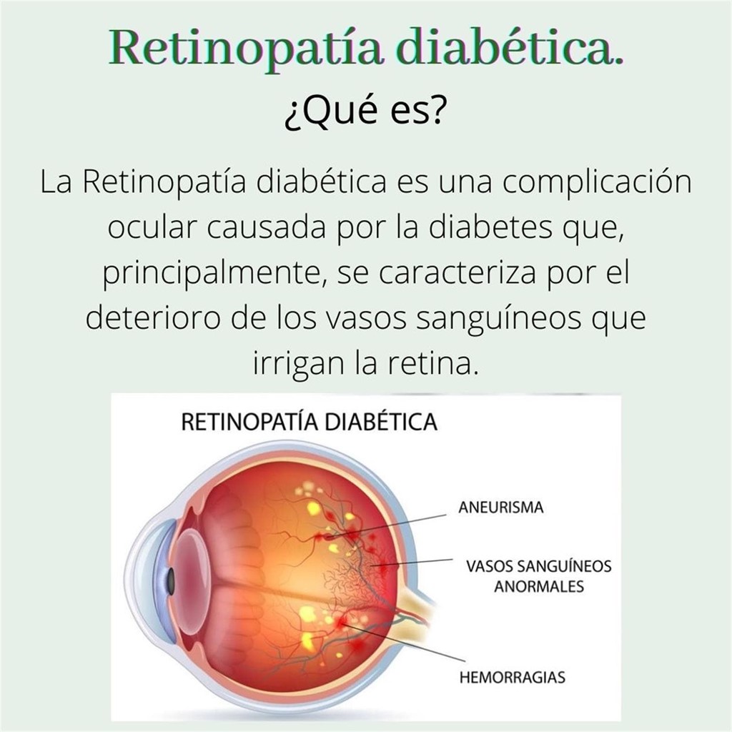 Diabetes y visión.