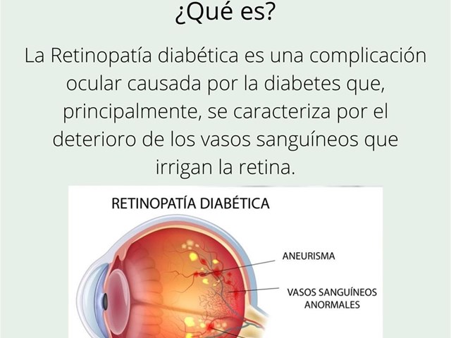 Diabetes y visión.