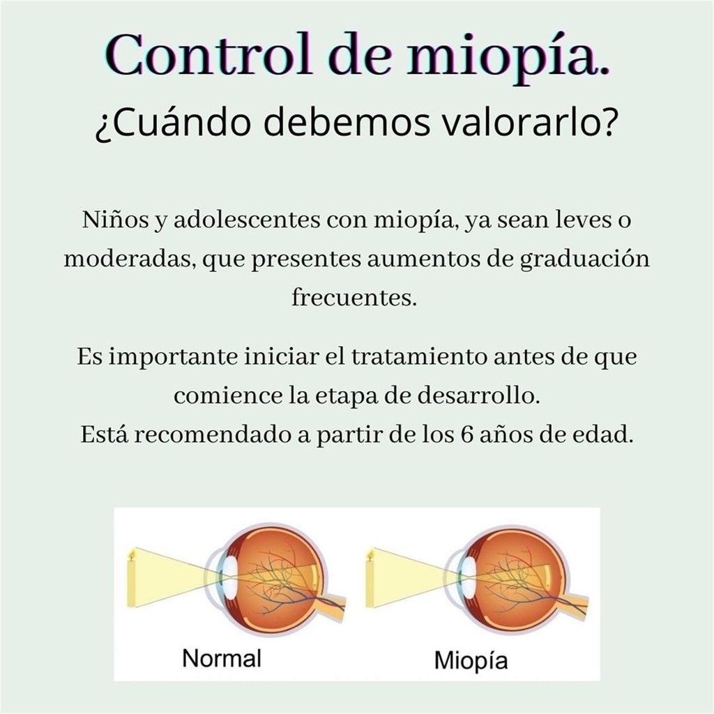 O teu fillo é miope?