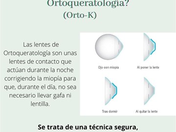 Ortoqueratología.