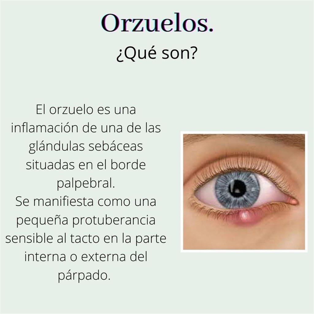 Orzuelos