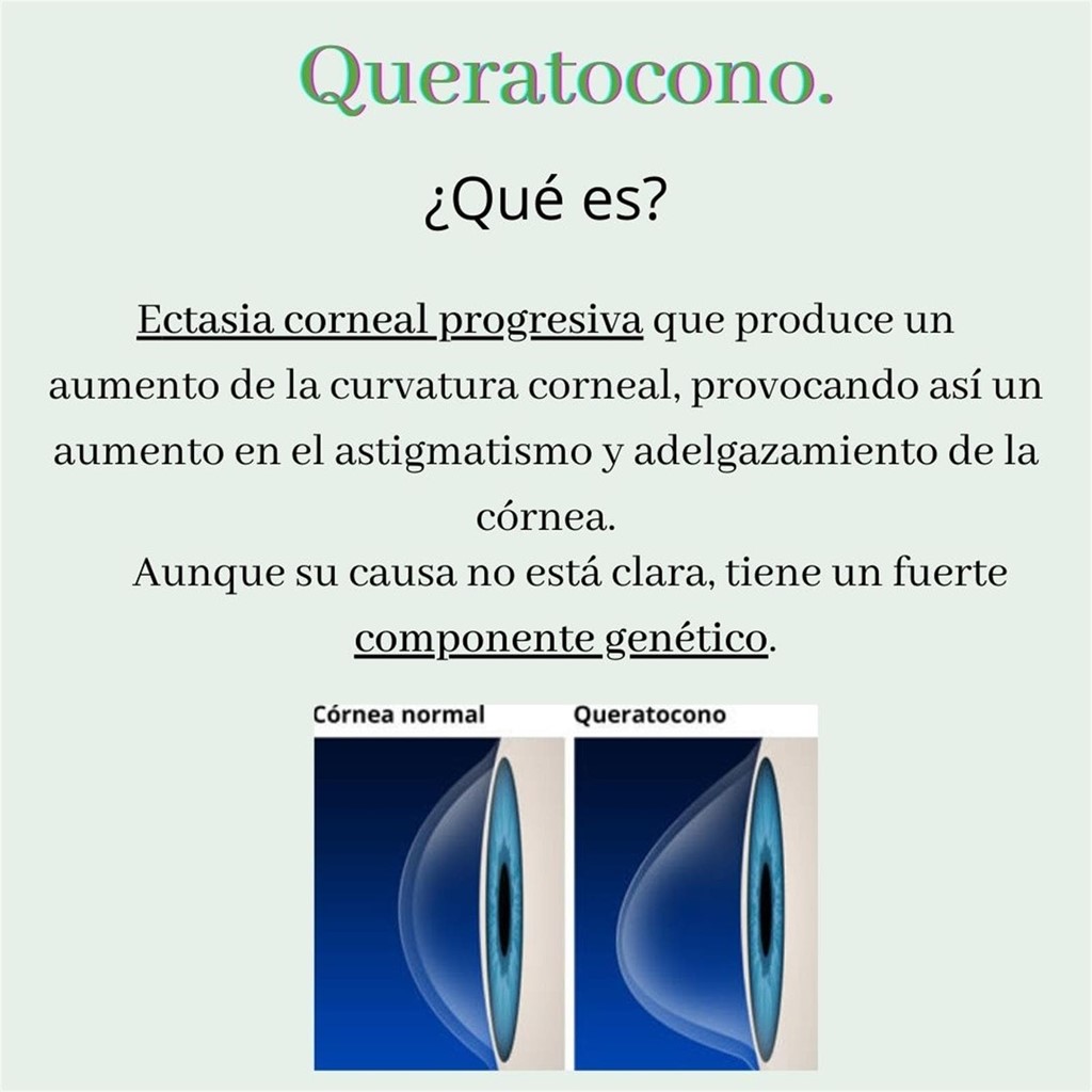 Queratocono.