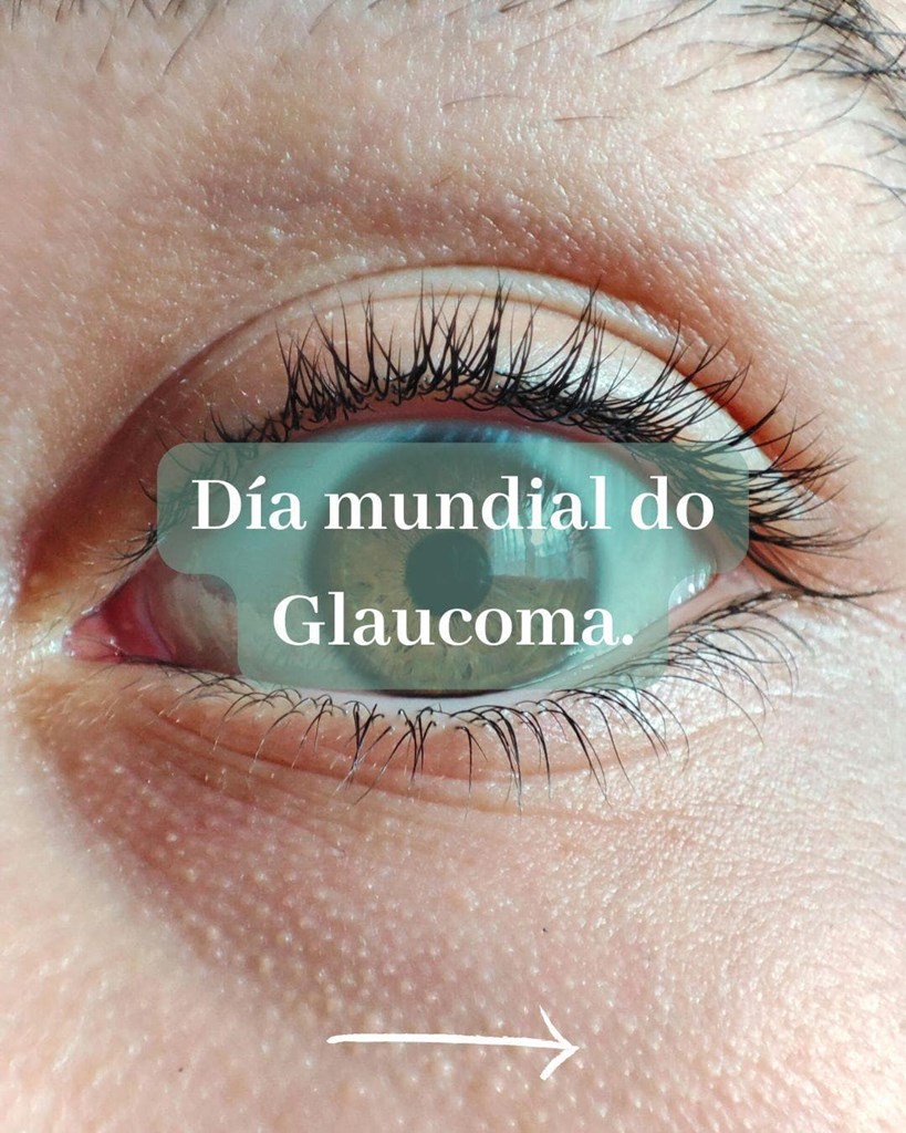 Visión e Glaucoma.