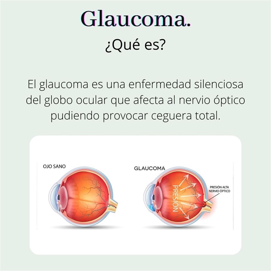 Glaucoma, ¿cómo prevenirlo?