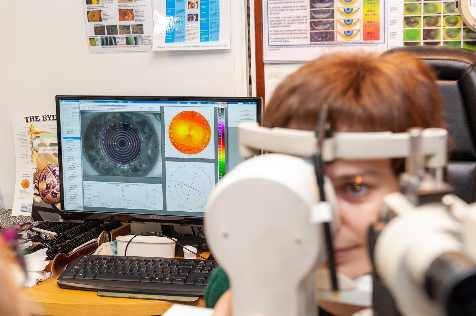 Olladas Centro Óptico - ¿Qué es la ortoqueratología?