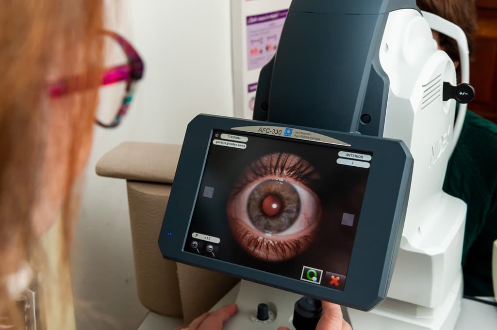 Olladas Centro Óptico - ¿Qué es la ortoqueratología?