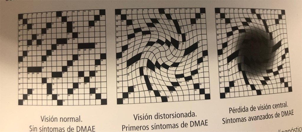 LA VISIÓN CON DMAE