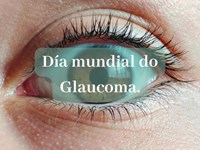 Visión y Glaucoma.
